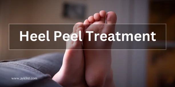 Heel Peel Treatment