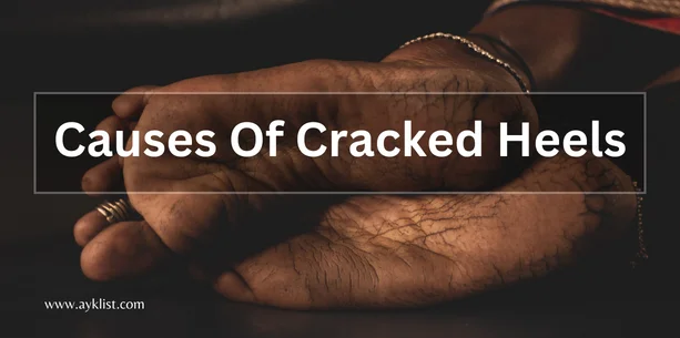 Causes Of Cracked Heels